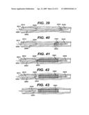  LOCAL ADMINISTRATION OF A COMBINATION OF RAPAMYCIN AND PANZEM FOR THE TREATMENT OF VULNERABLE PLAQUE diagram and image