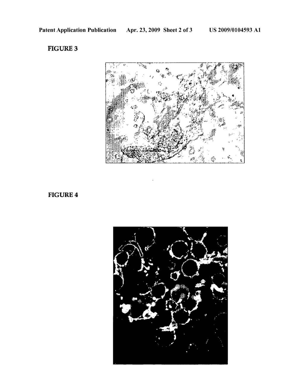 Preparation and Use of Basement Membrane Particles - diagram, schematic, and image 03