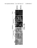 Psoriasin Expression By Breast Epithelial Cells diagram and image