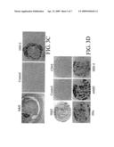 Psoriasin Expression By Breast Epithelial Cells diagram and image