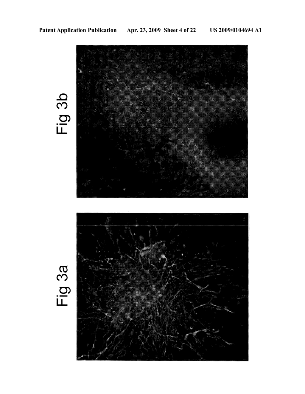 ISOLATION AND TRANSPLANTATION OF RETINAL STEM CELLS - diagram, schematic, and image 05