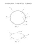 METHOD OF TREATING BENIGN HYPERTROPHY OF THE PROSTATE diagram and image