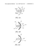 METHOD OF TREATING BENIGN HYPERTROPHY OF THE PROSTATE diagram and image