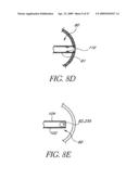 METHOD OF TREATING BENIGN HYPERTROPHY OF THE PROSTATE diagram and image