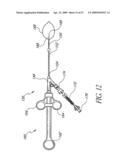 METHOD OF TREATING BENIGN HYPERTROPHY OF THE PROSTATE diagram and image