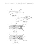 METHOD OF TREATING BENIGN HYPERTROPHY OF THE PROSTATE diagram and image