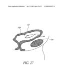 METHOD OF TREATING BENIGN HYPERTROPHY OF THE PROSTATE diagram and image