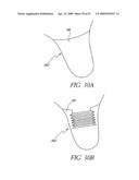 METHOD OF TREATING BENIGN HYPERTROPHY OF THE PROSTATE diagram and image