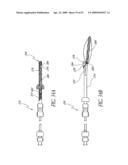 METHOD OF TREATING BENIGN HYPERTROPHY OF THE PROSTATE diagram and image