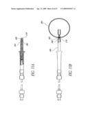 METHOD OF TREATING BENIGN HYPERTROPHY OF THE PROSTATE diagram and image