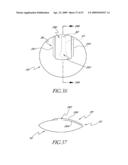 METHOD OF TREATING BENIGN HYPERTROPHY OF THE PROSTATE diagram and image