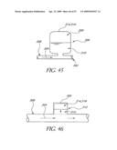 METHOD OF TREATING BENIGN HYPERTROPHY OF THE PROSTATE diagram and image