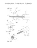 METHOD OF TREATING BENIGN HYPERTROPHY OF THE PROSTATE diagram and image