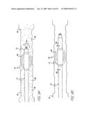 ULTRASOUND ASSEMBLY FOR USE WITH LIGHT ACTIVATED DRUGS diagram and image