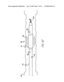 ULTRASOUND ASSEMBLY FOR USE WITH LIGHT ACTIVATED DRUGS diagram and image