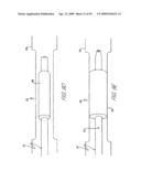 ULTRASOUND ASSEMBLY FOR USE WITH LIGHT ACTIVATED DRUGS diagram and image