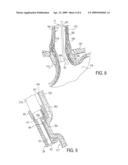 APPARATUS AND METHOD FOR TREATING TISSUE diagram and image