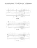 ADJUSTABLE-LENGTH DRUG DELIVERY BALLOON diagram and image