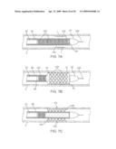 ADJUSTABLE-LENGTH DRUG DELIVERY BALLOON diagram and image