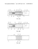 ADJUSTABLE-LENGTH DRUG DELIVERY BALLOON diagram and image