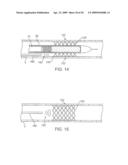 ADJUSTABLE-LENGTH DRUG DELIVERY BALLOON diagram and image