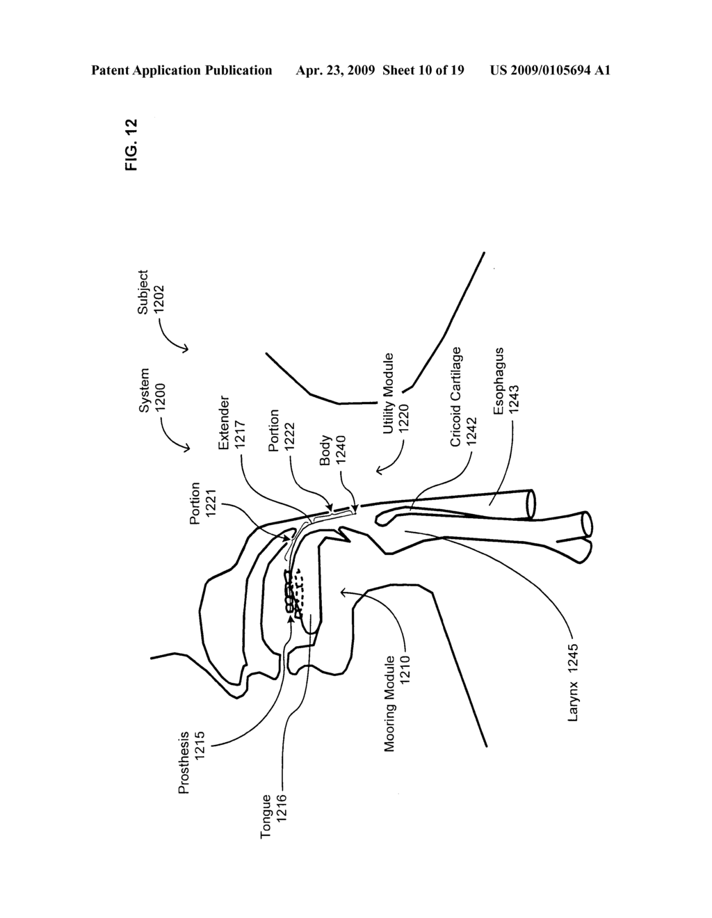 Medical or veterinary digestive tract utilization systems and methods - diagram, schematic, and image 11