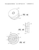 Cam-locking of cable for fracture plate diagram and image