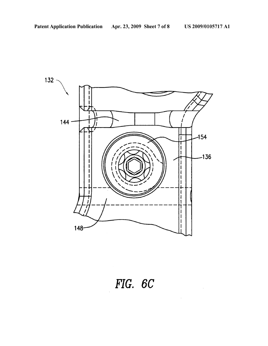 Cam-locking of cable for fracture plate - diagram, schematic, and image 08