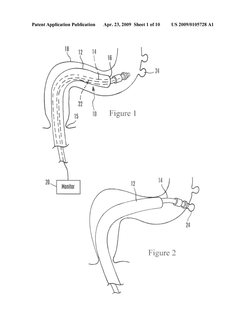 DEVICES AND METHODS FOR SECURING TISSUE - diagram, schematic, and image 02