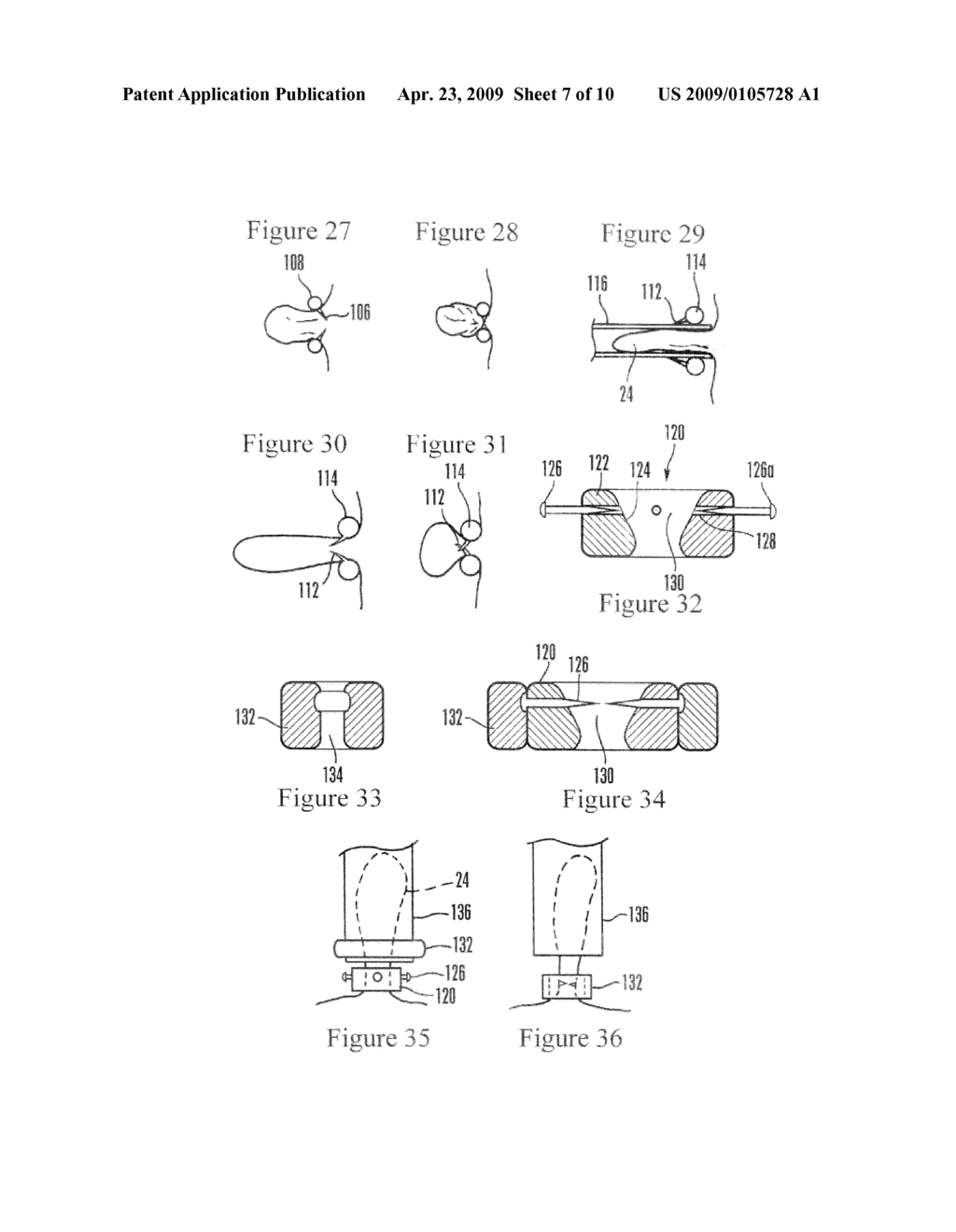 DEVICES AND METHODS FOR SECURING TISSUE - diagram, schematic, and image 08