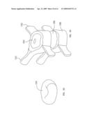 Mechanical apparatus and method for delivering materials into the inter-vertebral body space for nucleus replacement diagram and image