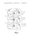 APPARATUS AND METHOD FOR CONNECTING SPINAL FIXATION SYSTEMS TOGETHER diagram and image