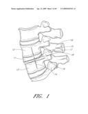 METHODS, SYSTEMS AND APPARATUSES FOR TORSIONAL STABILIZATION diagram and image