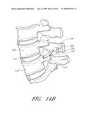 METHODS, SYSTEMS AND APPARATUSES FOR TORSIONAL STABILIZATION diagram and image