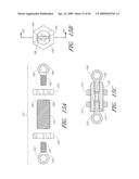 METHODS, SYSTEMS AND APPARATUSES FOR TORSIONAL STABILIZATION diagram and image