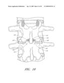 METHODS, SYSTEMS AND APPARATUSES FOR TORSIONAL STABILIZATION diagram and image