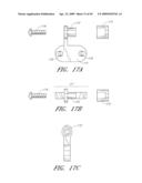 METHODS, SYSTEMS AND APPARATUSES FOR TORSIONAL STABILIZATION diagram and image