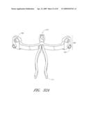 METHODS, SYSTEMS AND APPARATUSES FOR TORSIONAL STABILIZATION diagram and image