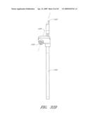 METHODS, SYSTEMS AND APPARATUSES FOR TORSIONAL STABILIZATION diagram and image