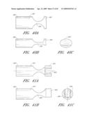 METHODS, SYSTEMS AND APPARATUSES FOR TORSIONAL STABILIZATION diagram and image