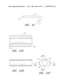 METHODS, SYSTEMS AND APPARATUSES FOR TORSIONAL STABILIZATION diagram and image