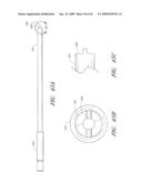 METHODS, SYSTEMS AND APPARATUSES FOR TORSIONAL STABILIZATION diagram and image