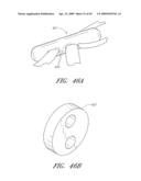 METHODS, SYSTEMS AND APPARATUSES FOR TORSIONAL STABILIZATION diagram and image