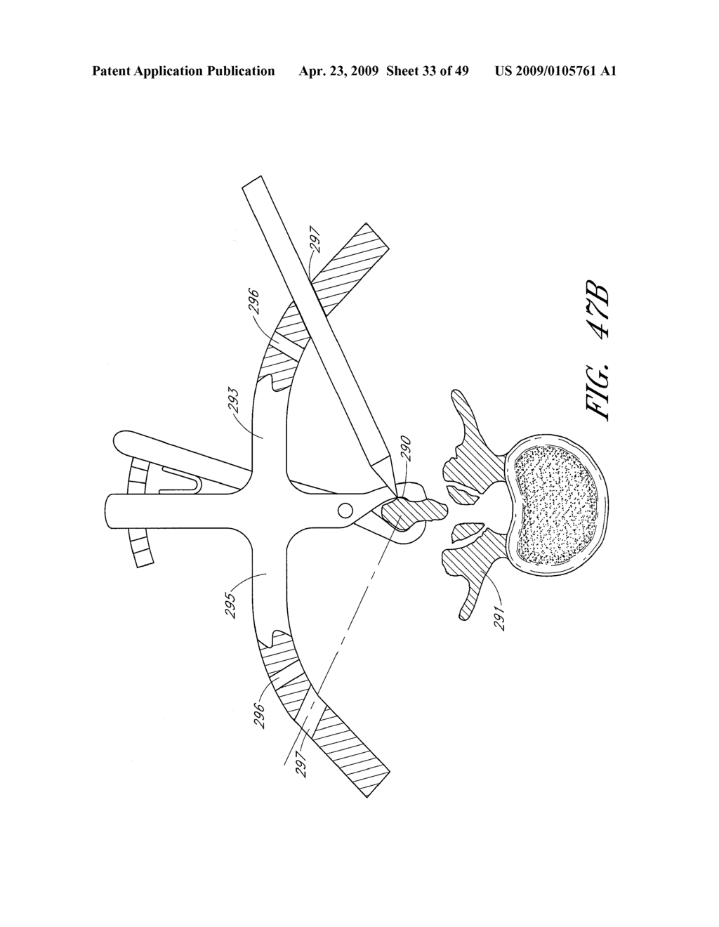 METHODS, SYSTEMS AND APPARATUSES FOR TORSIONAL STABILIZATION - diagram, schematic, and image 34