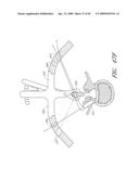 METHODS, SYSTEMS AND APPARATUSES FOR TORSIONAL STABILIZATION diagram and image