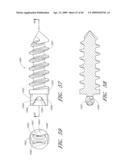 METHODS, SYSTEMS AND APPARATUSES FOR TORSIONAL STABILIZATION diagram and image