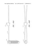 METHODS, SYSTEMS AND APPARATUSES FOR TORSIONAL STABILIZATION diagram and image