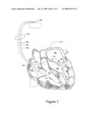 Cardiac Waveform Template Creation, Maintenance and Use diagram and image