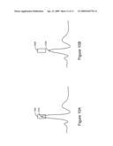 Cardiac Waveform Template Creation, Maintenance and Use diagram and image