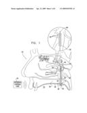 LONG-TERM SPG STIMULATION THERAPY FOR PREVENTION OF VASCULAR DEMENTIA diagram and image